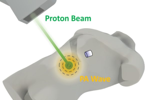 1. Radiacoustic imaging 1. Radiacoustic imaging